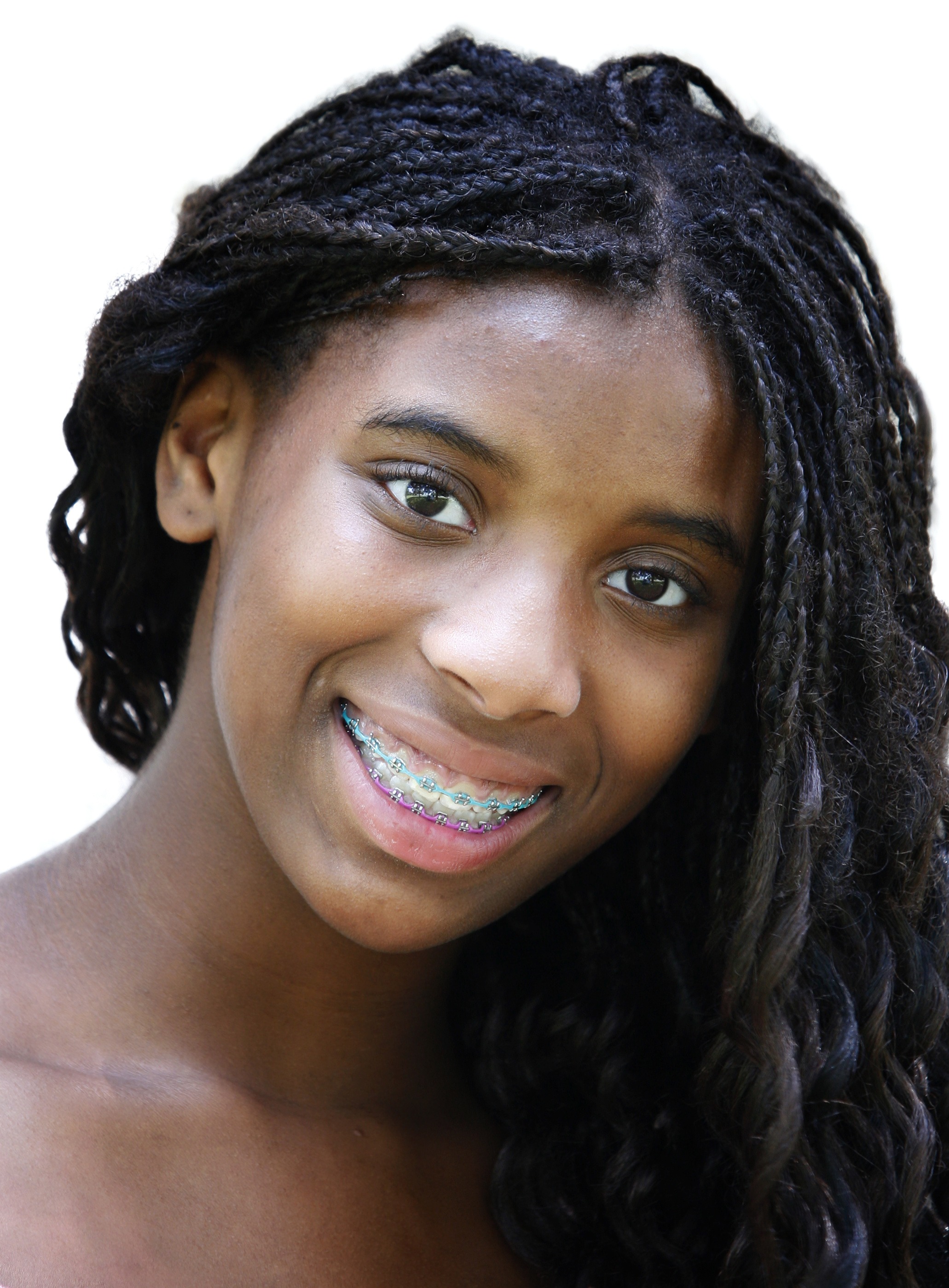 Beautiful AfricanAmerican Teenage Girl With Brace Du