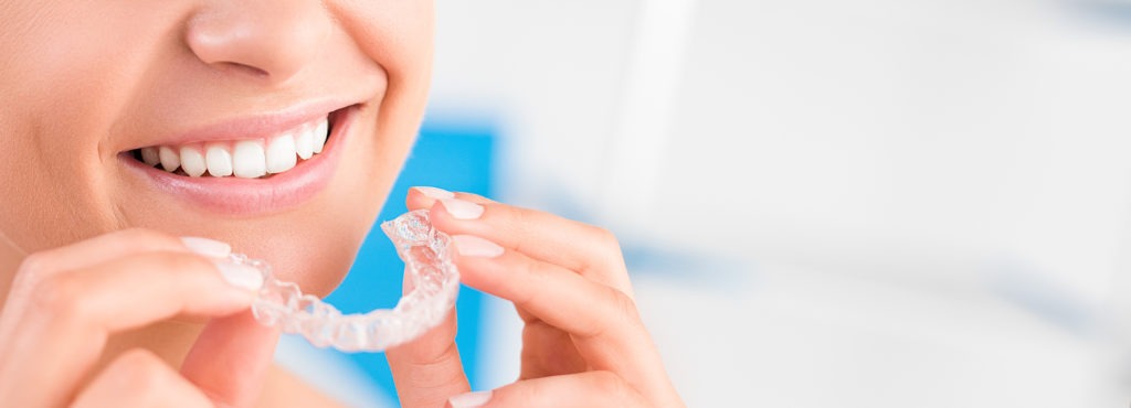 Closeup of Invisalign Aligner