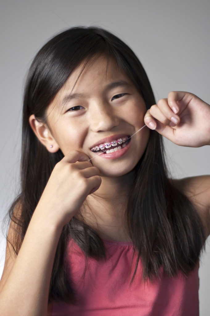 girl flossing with braces