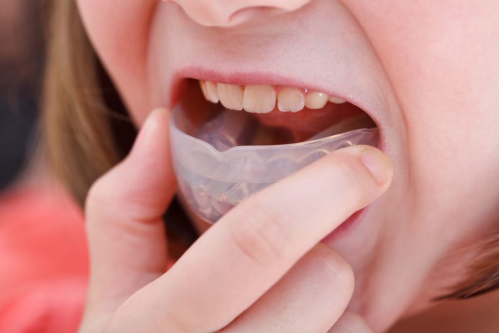 Sports Safety for Kid's Mouth & Orthodontic Emergencies