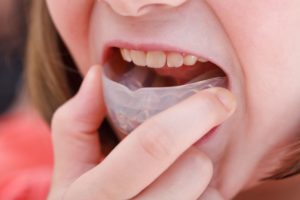 Sports Safety for Kid's Mouth & Orthodontic Emergencies