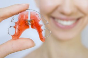 What to Know About Palatal Expanders