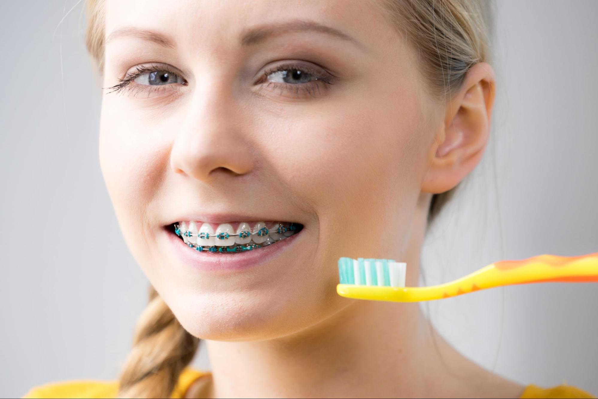 Brushing Tips for Braces Patients