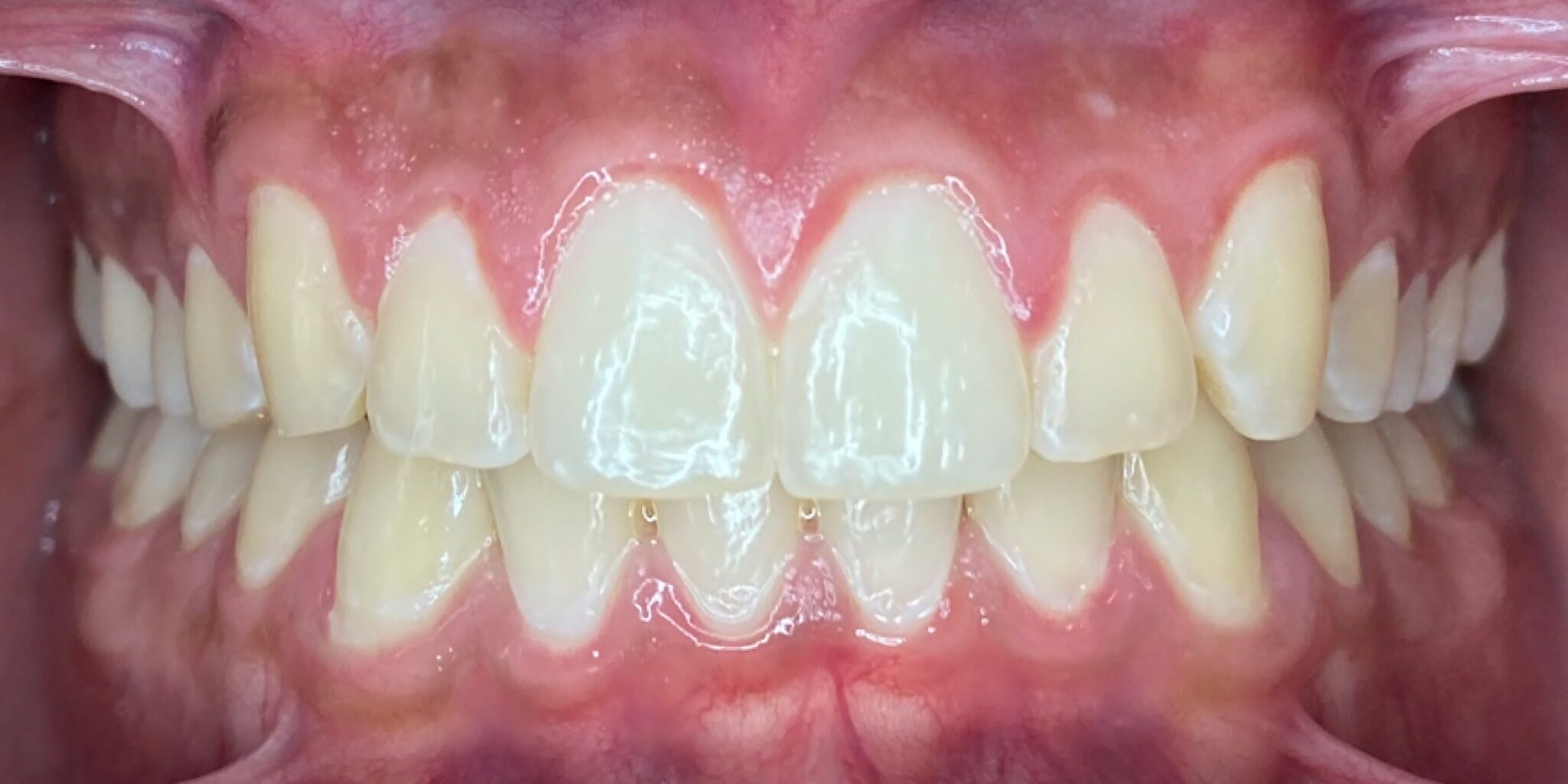 issaquah orthodontics